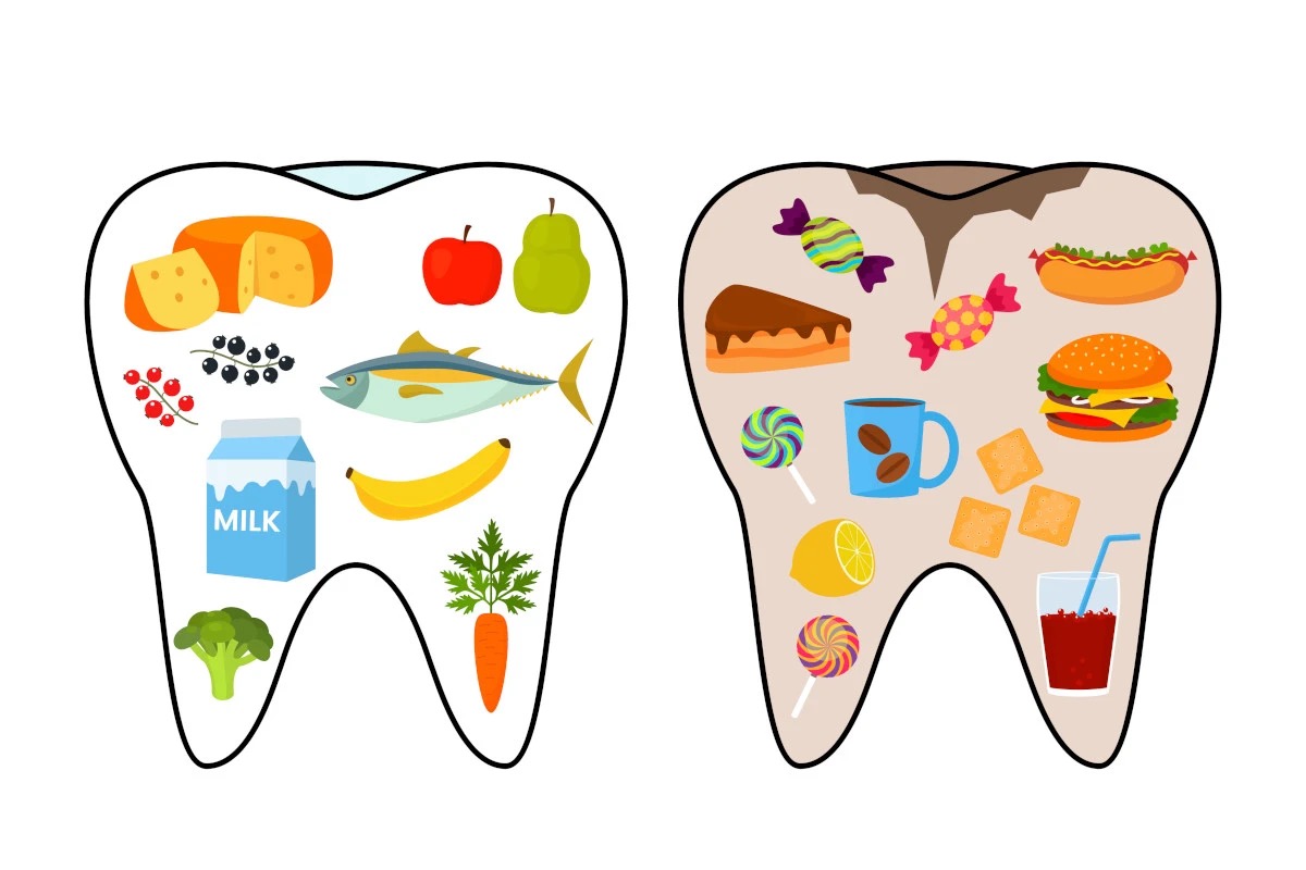 Alimentazione e sorriso: come il cibo aiuta l'igiene orale